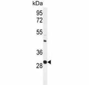 Western blot testing of mouse spleen tissue lysate with Upstream stimulatory factor 1 antibody. Predicted molecular weight ~28/34 kDa (two isoforms).