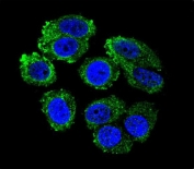 Immunofluorescent staining of human MCF7 cells with RARS antibody (green) and DAPI nuclear stain (blue).