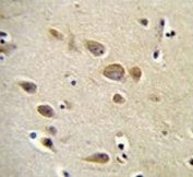 IHC testing of FFPE human brain tissue with RARS antibody. HIER: steam section in pH6 citrate buffer for 20 min and allow to cool prior to staining.