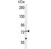 Western blot testing of human MCF7 cell lysate with RARS antibody. Predicted molecular weight ~75 kDa.