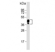 Western blot testing of human plasma lysate with Haptoglobin-related protein antibody. Predicted molecular weight: 43, 39 kDa (two isoforms).