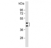 Western blot testing of human liver lysate with Haptoglobin-related protein antibody. Predicted molecular weight: 43, 39 kDa (two isoforms).