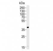 Western blot testing of human HL60 cell lysate with Haptoglobin-related protein antibody. Predicted molecular weight: 43, 39 kDa (two isoforms).
