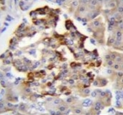 IHC testing of FFPE human pancreas tissue with GAD2 antibody. HIER: steam section in pH6 citrate buffer for 20 min and allow to cool prior to staining.