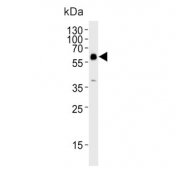 Western blot testing of rat brain tissue lysate with GAD2 antibody. Predicted molecular weight ~65 kDa.
