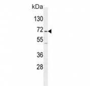 Western blot testing of human Jurkat cell lysate with GAD2 antibody. Predicted molecular weight ~65 kDa.