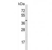Western blot testing of human Jurkat cell lysate with HDAC11 antibody. Predicted molecular weight ~39 kDa.