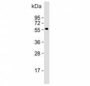 Western blot testing of mouse uterus lysate with Inhibin beta B chain antibody. Expected molecular weight: 17 kDa (mature form), 42 kDa (pro peptide form) and 55 kDa (pro form).