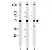 Western blot testing of 1) human A549, 2) human PC-3 and 3) mouse testis lysate with Inhibin beta B chain antibody. Expected molecular weight: 17 kDa (mature form), 42 kDa (pro peptide form) and 55 kDa (pro form).