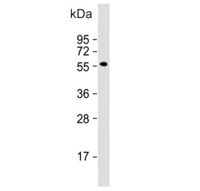 Western blot testing of mouse uterus lysate with Inhibin beta B chain antibody. Expected molecular weight: 17 kDa (mature form), 42 kDa (pro peptide form) and 55 kDa (pro form).