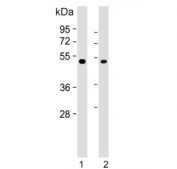 Western blot testing of human 1) A549 and 2) SK-BR-3 cell lysate with Inhibin beta B chain antibody. Expected molecular weight: 17 kDa (mature form), 42 kDa (pro peptide form) and 55 kDa (pro form).