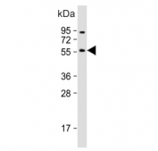 Western blot testing of human HepG2 cell lysate with CYP11B2 antibody. Predicted molecular weight ~58 kDa.