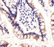 IHC testing of FFPE human small intestine tissue with CYP11B2 antibody. HIER: steam section in pH6 citrate buffer for 20 min and allow to cool prior to staining.