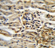 IHC testing of FFPE mouse kidney tissue with CYP11B2 antibody. HIER: steam section in pH6 citrate buffer for 20 min and allow to cool prior to staining.