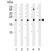 Western blot testing of 1) human kidney, 2) human plasma, 3) mouse kidney, 4) mouse plasma and 5) rat kidney lysate with GPX3 antibody. Expected molecular weight: 23-26 kDa.
