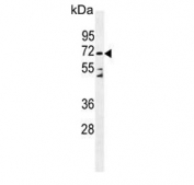 Western blot testing of human HL60 cell lysate with Dipeptidyl peptidase 3 antibody. Expected molecular weight ~83 kDa and ~70 kDa (DPP3-BBS1).