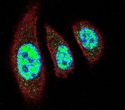 Immunofluorescent staining of human A549 cells with Tyrosyl-DNA phosphodiesterase 2 antibody (green), DAPI nuclear stain (blue) and anti-Actin (red).