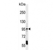Western blot testing of mouse liver tissue lysate with EXOC3L1 antibody. Predicted molecular weight ~82 kDa.