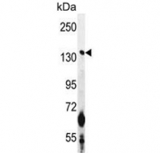 Western blot testing of mouse Neuro-2a cell lysate with CAMSAP1 antibody. Predicted molecular weight ~178 kDa.