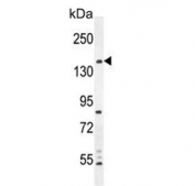 Western blot testing of human MDA-MB-435 cell lysate with CAMSAP1 antibody. Predicted molecular weight ~178 kDa.
