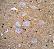 IHC testing of FFPE human brain tissue with CAMSAP1 antibody. HIER: steam section in pH6 citrate buffer for 20 min and allow to cool prior to staining.