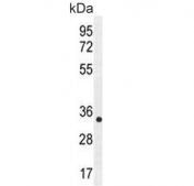 Western blot testing of human MDA-MB-435 cell lysate with ALKBH6 antibody. Predicted molecular weight ~26 kDa.