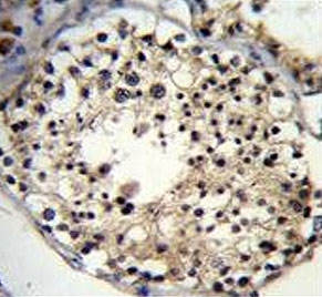 IHC testing of FFPE human testis tissue with ALKBH6 antibody. HIER: steam section in pH6 citrate buffer for 20 min and allow to cool prior to staining.