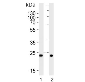 Western blot testing of 1) human ovary and 2) mouse testis tissue lysate with MitoPLD antibody. Predicted molecular weight ~28 kDa.~