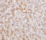 IHC testing of FFPE human liver tissue with CLEC4F antibody. HIER: steam section in pH6 citrate buffer for 20 min and allow to cool prior to staining.