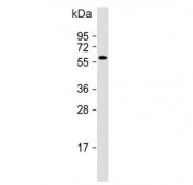 Western blot testing of human CCRF-CEM cell lysate with CLEC4F antibody. Predicted molecular weight ~66 kDa.