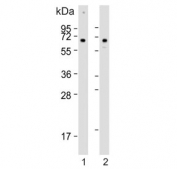 Western blot testing of human 1) HeLa and 2) U-2 OS cell lysate with CLEC4F antibody. Predicted molecular weight ~66 kDa.