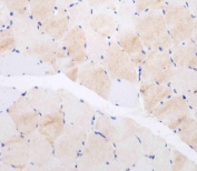 IHC testing of FFPE human skeletal muscle tissue with CLEC4F antibody. HIER: steam section in pH6 citrate buffer for 20 min and allow to cool prior to staining.