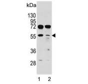Western blot testing of human 1) NCI-H460 and 2) HeLa cell lysate with TSPYL6 antibody. Predicted molecular weight ~46 kDa.
