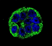 Immunofluorescent staining of human WiDr cells with OTU1 antibody (green) and DAPI nuclear stain (blue).