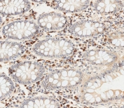IHC testing of FFPE human colon tissue with OTU1 antibody. HIER: steam section in pH6 citrate buffer for 20 min and allow to cool prior to staining.