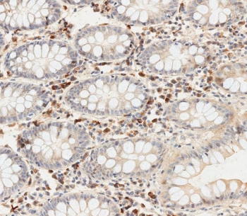 IHC testing of FFPE human colon tissue with OTU1 antibody. HIER: steam section in pH6 citrate buffer for 20 min and allow to cool prior to staining.