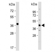 Western bot testing of two different lots of human K562 cell lysate with OTU1 antibody. Predicted molecular weight ~38 kDa.