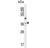 Western blot testing of human HeLa cell lysate with Selenoprotein V antibody. Predicted molecular weight ~37 kDa.