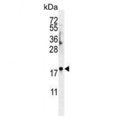 Western blot testing of human NCI-H460 cell lysate with FAM218A antibody. Predicted molecular weight ~17 kDa.