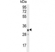 Western blot testing of human A2058 cell lysate with UBXN2A antibody. Predicted molecular weight ~29 kDa.