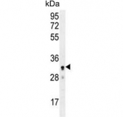 Western blot testing of human A2058 cell lysate with UBXN2A antibody. Predicted molecular weight ~29 kDa.