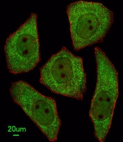 Immunofluorescent staining of human U251 cells with LRRC45 antibody (green) and anti-Actin (red).