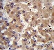 IHC testing of FFPE human liver tissue with PRAMEF6 antibody. HIER: steam section in pH6 citrate buffer for 20 min and allow to cool prior to staining.