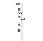 Western blot testing of human NCI-H460 cell lysate with PRAMEF6 antibody. Predicted molecular weight ~55 kDa.