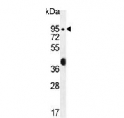 Western blot testing of human MCF7 cell lysate with Rac GTPase-activating protein 1 antibody. Predicted molecular weight ~71 kDa.