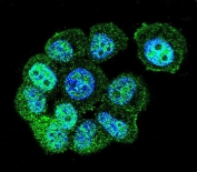 Immunofluorescent staining of human MCF7 cells with Rac GTPase-activating protein 1 antibody (green) and DAPI nuclear stain (blue).