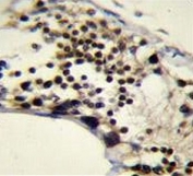 IHC testing of FFPE human testis tissue with Rac GTPase-activating protein 1 antibody. HIER: steam section in pH6 citrate buffer for 20 min and allow to cool prior to staining.