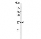 Western blot testing of human HL60 cell lysate with CNIH2 antibody. Predicted molecular weight ~19 kDa.