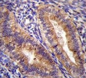 IHC testing of FFPE human uterus tissue with Cyclooxygenase 2 antibody. HIER: steam section in pH6 citrate buffer for 20 min and allow to cool prior to staining.