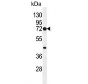Western blot testing of human HeLa cell lysate with Cyclooxygenase 2 antibody. Predicted molecular weight ~69 kDa.
